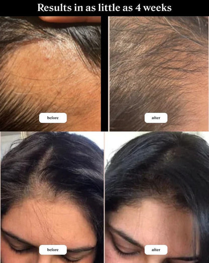 Shampoo y aceite de Batana