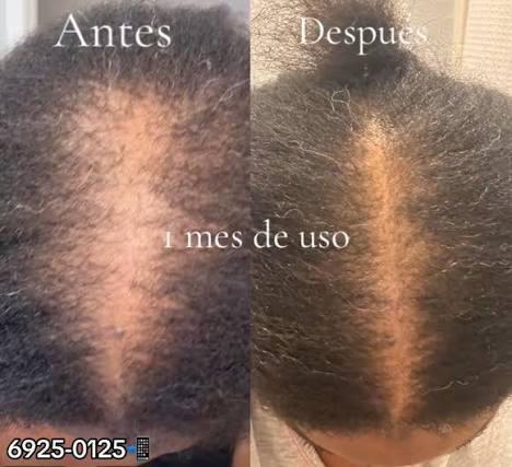 Shampoo y aceite de Batana