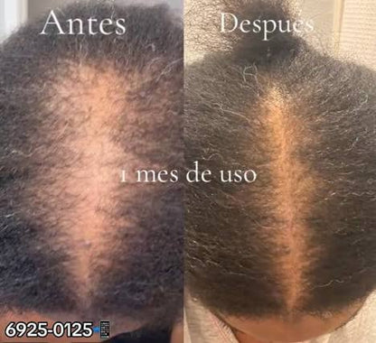Shampoo y aceite de Batana