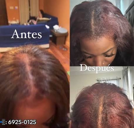 Shampoo y aceite de Batana
