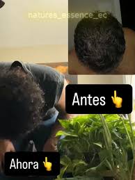 Shampoo y aceite de Batana